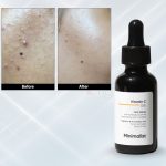 Minimalist Vitamin C 10% Face Serum 30ml - Image 5