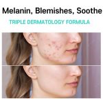 Care:Nel Anti-Melasma Cica Cream 40ml - Image 2