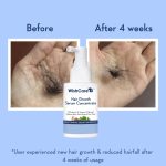 WishCare Hair Growth Serum Concentrate 30ml - Image 3