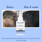 WishCare Hair Growth Serum Concentrate 30ml - Image 4
