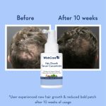 WishCare Hair Growth Serum Concentrate 30ml - Image 5