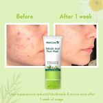 WishCare 2% Salicylic Acid Face Wash 100ml - Image 2