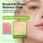 Anua Azelaic Acid 10 Hyaluron Redness Soothing Serum 30ml - Image 6