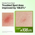 Anua Azelaic Acid 10 Hyaluron Redness Soothing Serum 30ml - Image 3