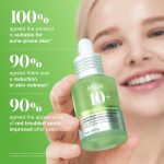 Anua Azelaic Acid 10 Hyaluron Redness Soothing Serum 30ml - Image 7