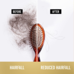 Pantene Anti-Hairfall Shampoo - Image 4